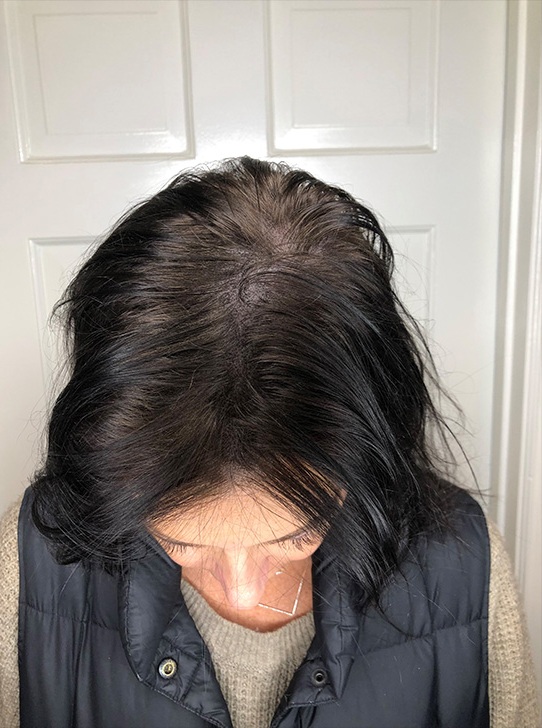 Scalp_1-1296x728-Header - Copy