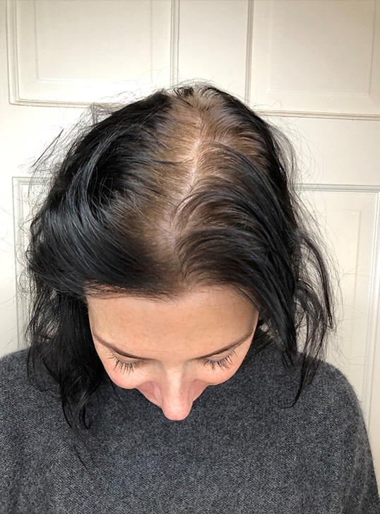 Scalp_1-1296x728-Header